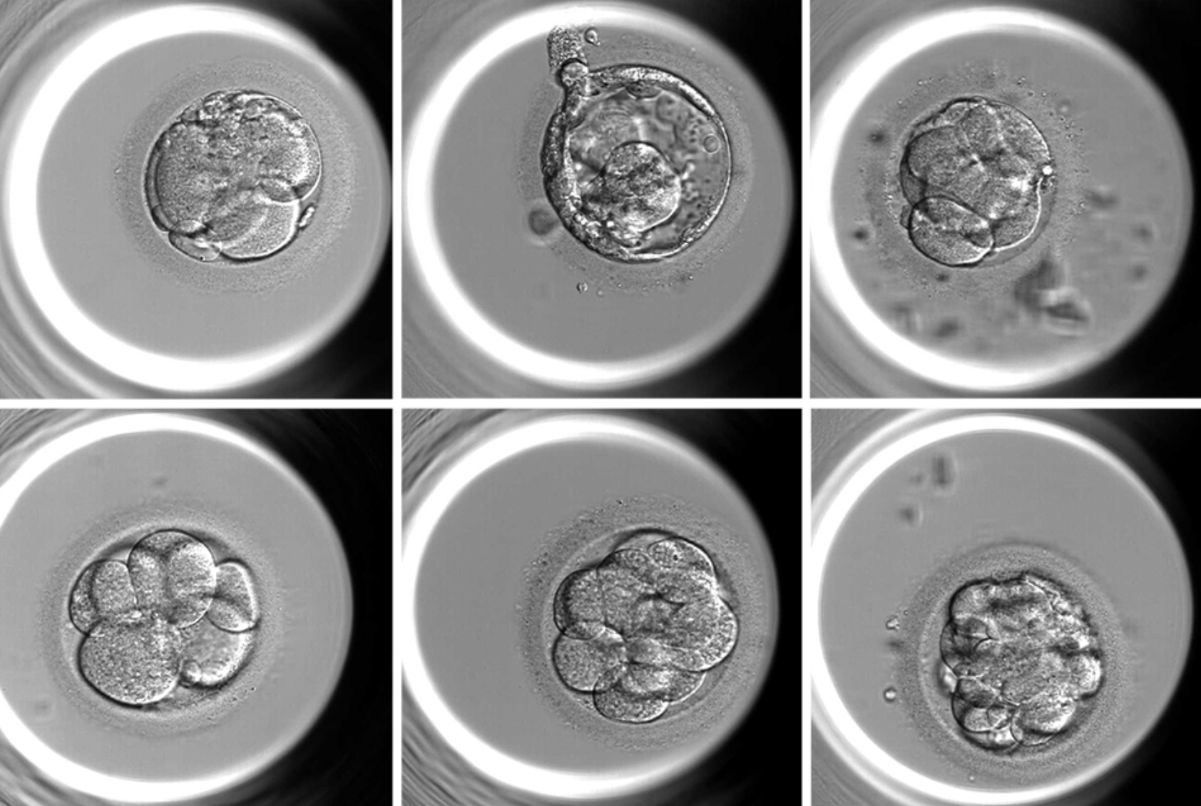 AI-based tool can assist embryologists in determining both the embryo quality score and ploidy status, providing a comprehensive assessment of the embryo. Courtesy of Suraj Rajendran.