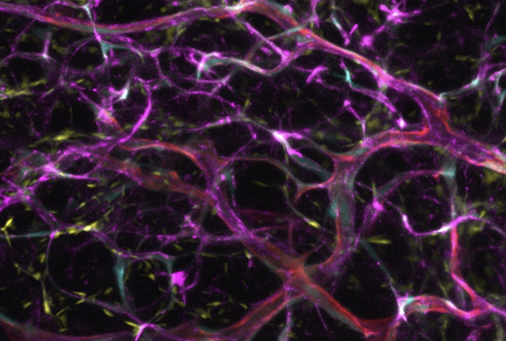The blood vessels pictured above formed after human endothelial cells from fat tissue were expanded in culture and transplanted into immunodeficient recipient mice. Credit: Dr. Yang Lin The blood vessels pictured above formed after human endothelial cells from fat tissue were expanded in culture and transplanted into immunodeficient recipient mice. Credit: Dr. Yang Lin