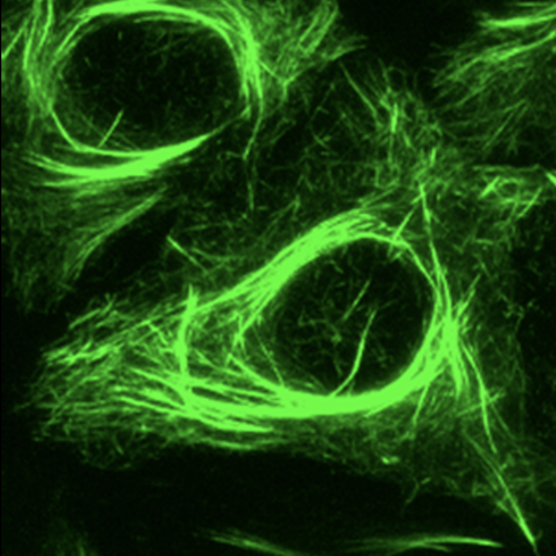 Pictured above are prostate cancer cells treated with a chemotherapy taxane drug labled with green fluorescence. The drug binds to and stablizes microtubules inside the cells, triggering cell death. Credit: Giannakakou Lab