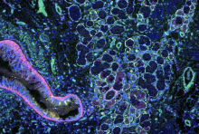 Mass cytometry image of a healthy lung. The red structure on the left is an airway; the yellow round structures in middle are submucosal glands, and the small round green structures are blood vessels. Image courtesy of Junbum Kim.