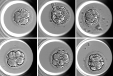 A Fully Automated AI-Based System for Assessing IVF Embryo Quality AI-based tool can assist embryologists in determining both the embryo quality score and ploidy status, providing a comprehensive assessment of the embryo. Courtesy of Suraj Rajendran.