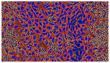 A colorized image of adult mobilized blood stem cells (small and roundish) into which Fli-1 modified mRNA has been introduced, expanding on top of engineered vascular endothelial cells.
