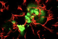 Islet-specific endothelial cells (red) form specialized blood vessels that support and nourish pancreatic islets (green). Credit: Dr. Ge Li